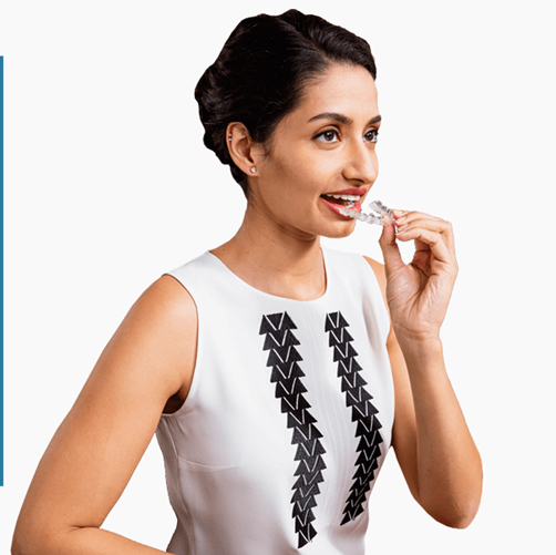 Who are Spark aligners for? Who are Spark aligners for?